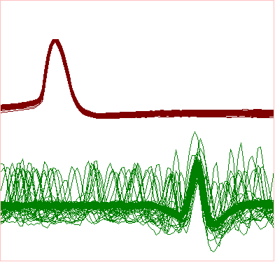 CPR spikes superimposed